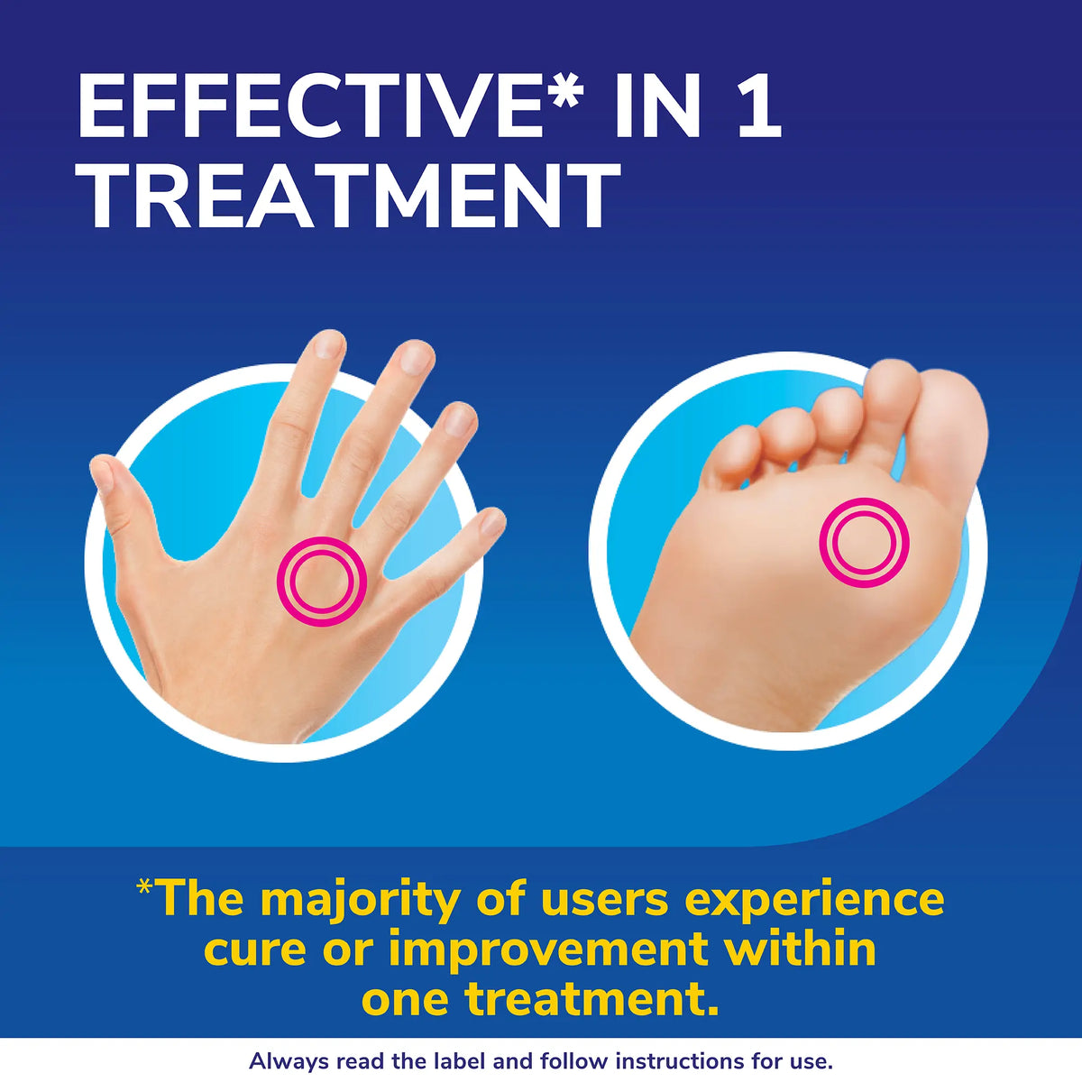 Dr. Scholl’s™ Freeze Away MAX Verruca and Wart Remover