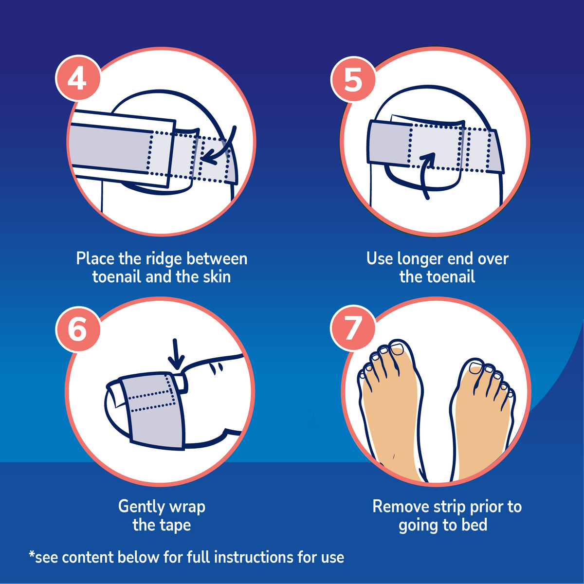 Ingrown Toenail 12-Hour Pain Relief Strips
