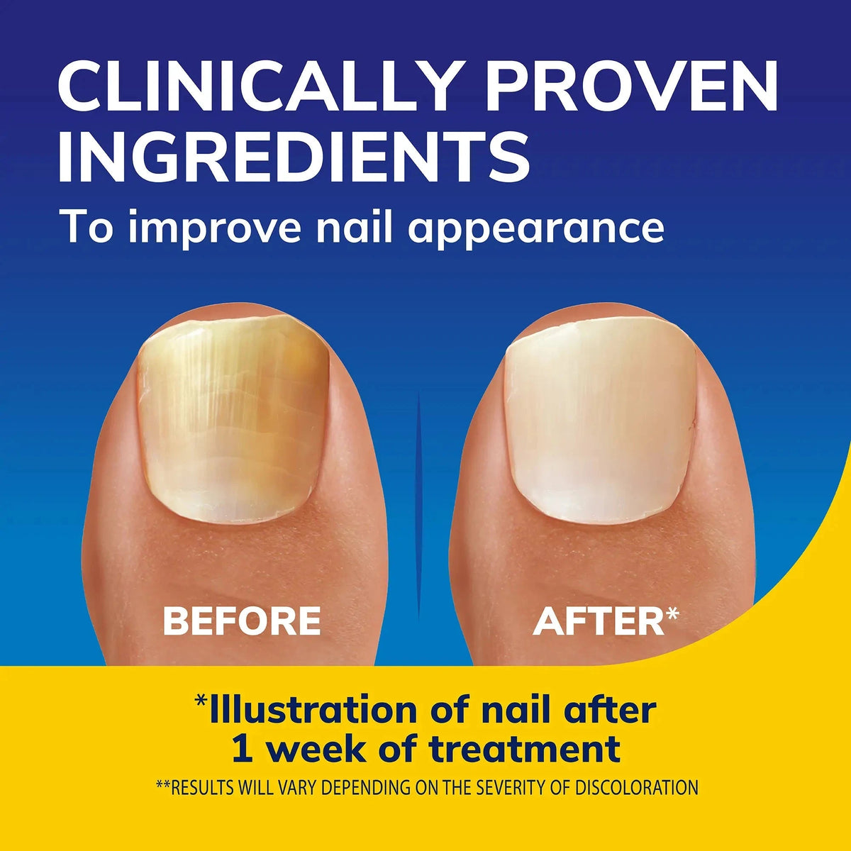 Scholl Aid Nail Revitaliser Serum 10ml
