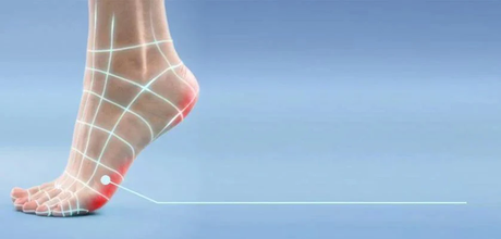 Hard Skin on Feet &amp; Cracked Heels
