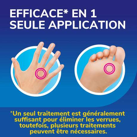 Dr Scholl's Traitement verrues Freeze Away MAX mains et pieds par cryothérapie