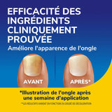 Sérum revitalisant Dr. Scholl’s pour ongles jaunis, décolorés ou abîmés 10ml