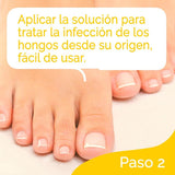 Scholl Tratamiento Anti-Hongos para uñas