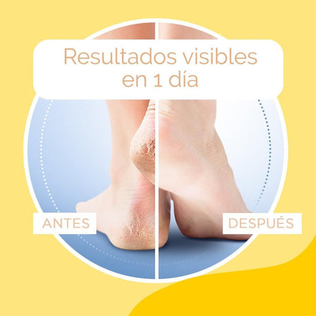 Scholl Crema para Talones Agrietados