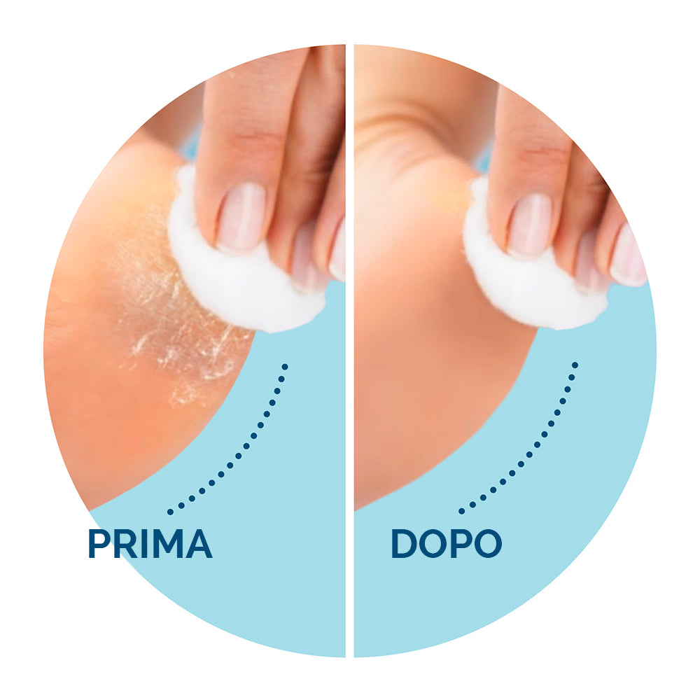 Velvet Roll do pedicure z dodatkową szczotką złuszczającą