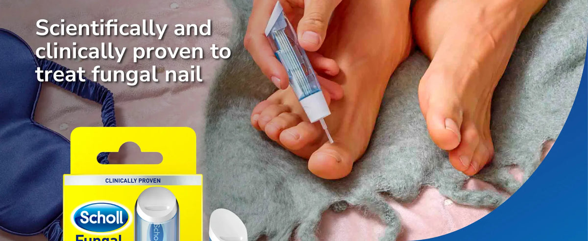 Fungal Nail Treatment