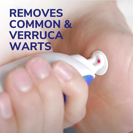 Scholl Aid Freeze Away Max Verruca and Wart Remover for Hands and Feet