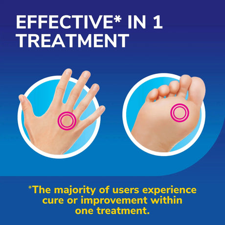 Scholl Aid Freeze Away Max Verruca and Wart Remover for Hands and Feet