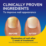 Scholl Aid Nail Revitaliser Serum 10ml