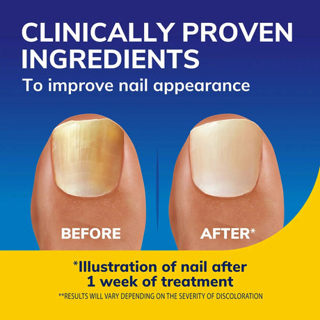 Scholl Aid Nail Revitaliser Serum 10ml