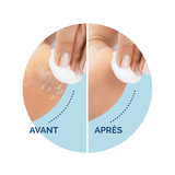 Scholl Velvet Smooth-refillruller med ultrapeeling