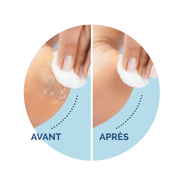 Scholl Velvet Smooth-refillruller med ultrapeeling